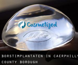 Borstimplantaten in Caerphilly (County Borough)