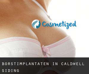 Borstimplantaten in Caldwell Siding