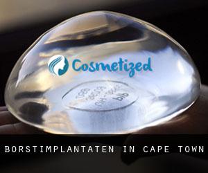 Borstimplantaten in Cape Town