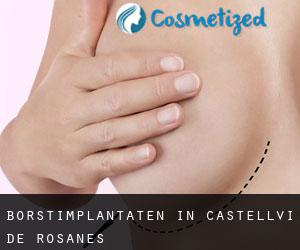 Borstimplantaten in Castellví de Rosanes