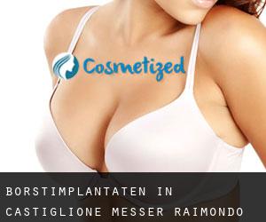 Borstimplantaten in Castiglione Messer Raimondo