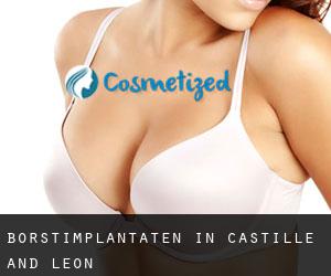 Borstimplantaten in Castille and León