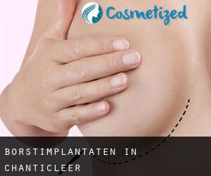 Borstimplantaten in Chanticleer