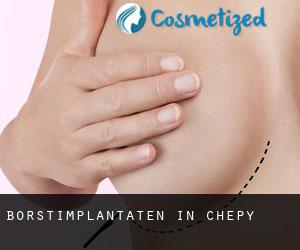 Borstimplantaten in Chepy