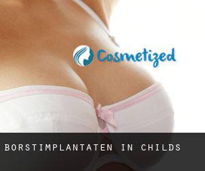 Borstimplantaten in Childs