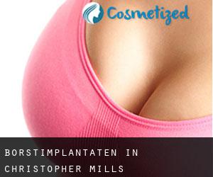 Borstimplantaten in Christopher Mills