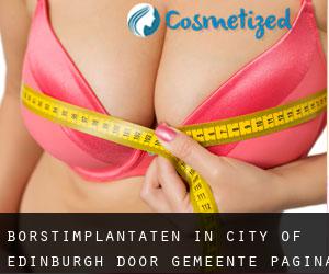 Borstimplantaten in City of Edinburgh door gemeente - pagina 1
