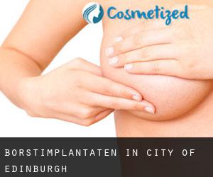 Borstimplantaten in City of Edinburgh