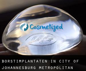 Borstimplantaten in City of Johannesburg Metropolitan Municipality door grootstedelijk gebied - pagina 1