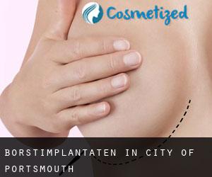 Borstimplantaten in City of Portsmouth
