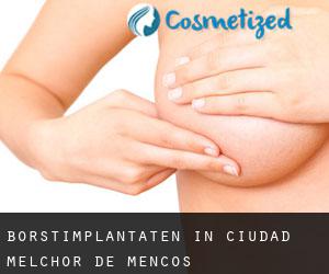Borstimplantaten in Ciudad Melchor de Mencos