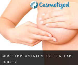 Borstimplantaten in Clallam County
