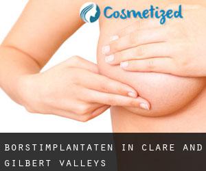 Borstimplantaten in Clare and Gilbert Valleys