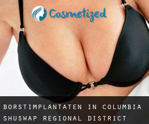 Borstimplantaten in Columbia-Shuswap Regional District