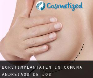 Borstimplantaten in Comuna Andreiaşu de Jos