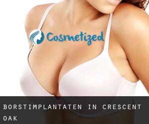 Borstimplantaten in Crescent Oak