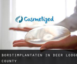 Borstimplantaten in Deer Lodge County