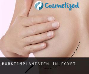 Borstimplantaten in Egypt