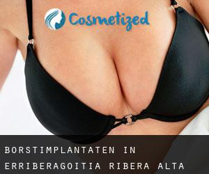 Borstimplantaten in Erriberagoitia / Ribera Alta Borstimplantaten in Erriberagoitia / Ribera Alta