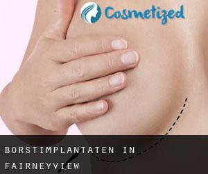 Borstimplantaten in Fairneyview