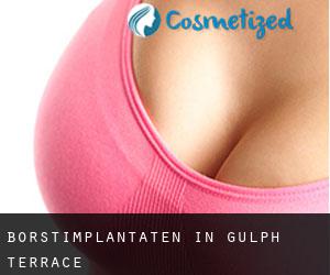 Borstimplantaten in Gulph Terrace