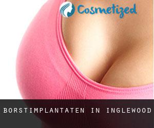 Borstimplantaten in Inglewood