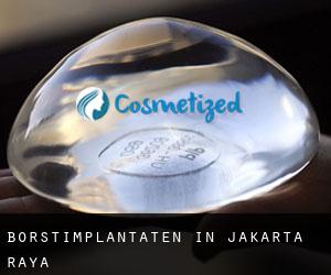 Borstimplantaten in Jakarta Raya