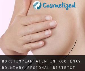 Borstimplantaten in Kootenay-Boundary Regional District