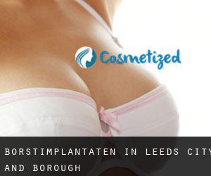 Borstimplantaten in Leeds (City and Borough)