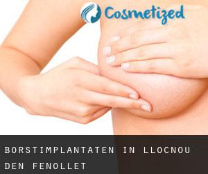 Borstimplantaten in Llocnou d'En Fenollet