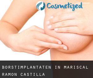 Borstimplantaten in Mariscal Ramon Castilla