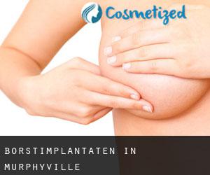 Borstimplantaten in Murphyville