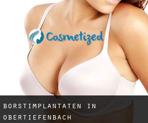 Borstimplantaten in Obertiefenbach