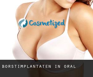 Borstimplantaten in Oral