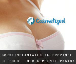 Borstimplantaten in Province of Bohol door gemeente - pagina 1