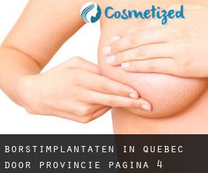 Borstimplantaten in Quebec door Provincie - pagina 4