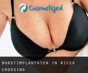 Borstimplantaten in Rices Crossing