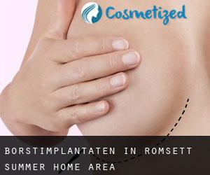 Borstimplantaten in Romsett Summer Home Area