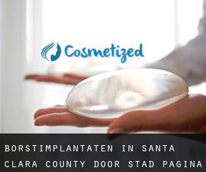 Borstimplantaten in Santa Clara County door stad - pagina 3