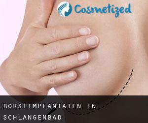 Borstimplantaten in Schlangenbad