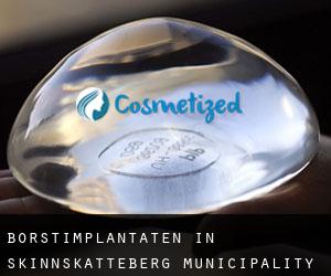 Borstimplantaten in Skinnskatteberg Municipality