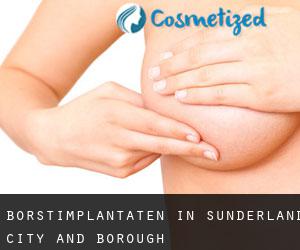 Borstimplantaten in Sunderland (City and Borough)
