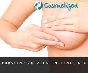 Borstimplantaten in Tamil Nādu