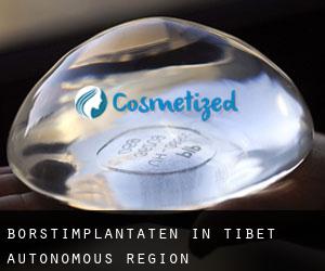 Borstimplantaten in Tibet Autonomous Region