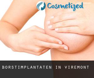 Borstimplantaten in Viremont