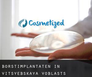 Borstimplantaten in Vitsyebskaya Voblastsʼ