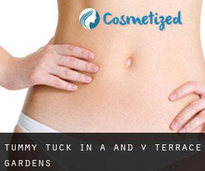 Tummy Tuck in A and V Terrace Gardens
