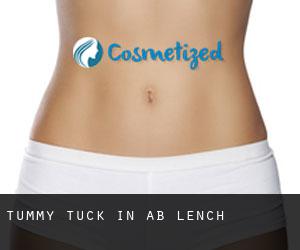 Tummy Tuck in Ab Lench