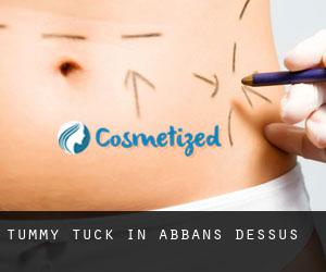 Tummy Tuck in Abbans-Dessus