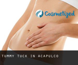 Tummy Tuck in Acapulco